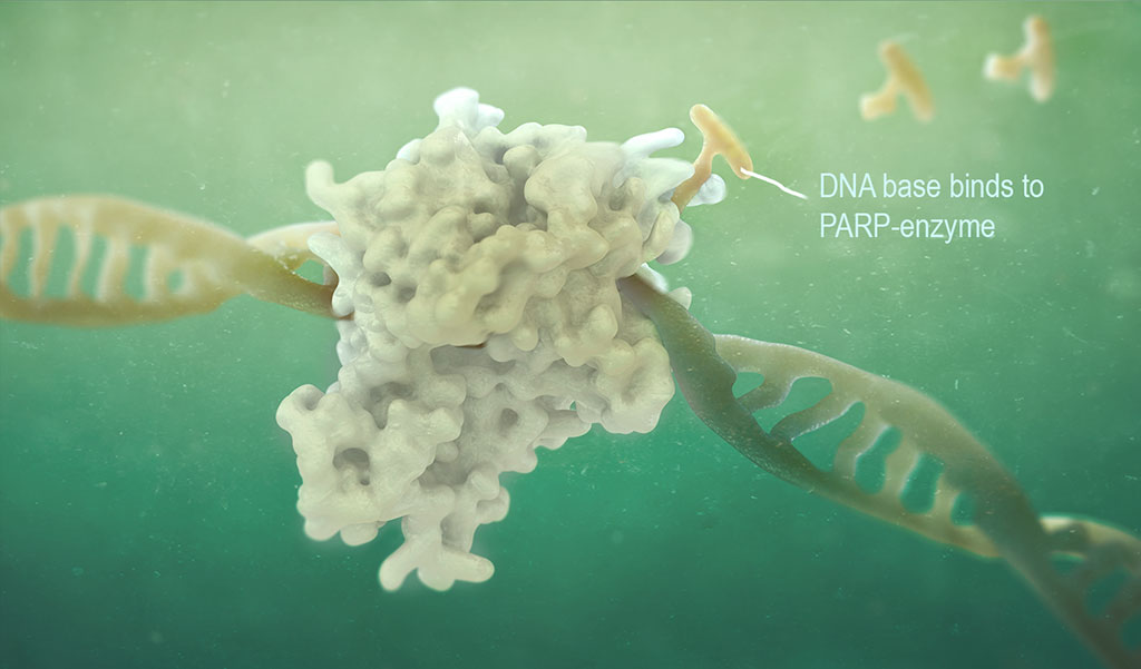 PARP restores DNA